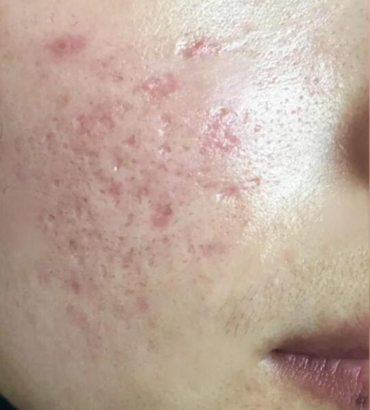 🔥3次点阵激光换皮记