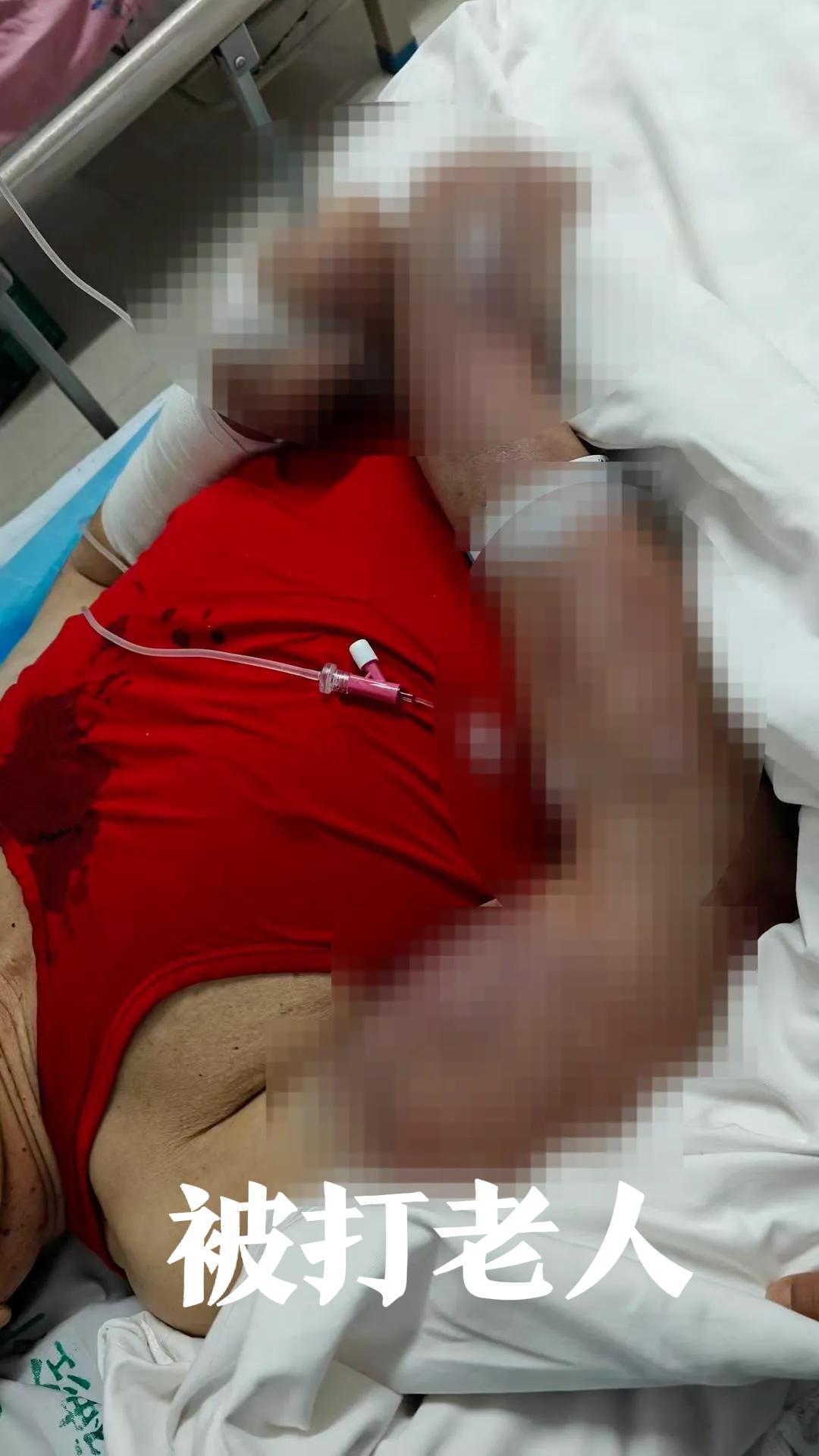 内蒙古赤峰，这位老人属实惨！73岁的他本以为住进正规养老院，能够安度余生，万万没