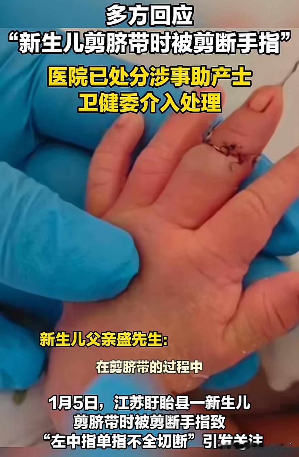 真的离谱！剪脐带剪断新生儿手指，这是正规医院吗？

2025年12月25日江苏盱