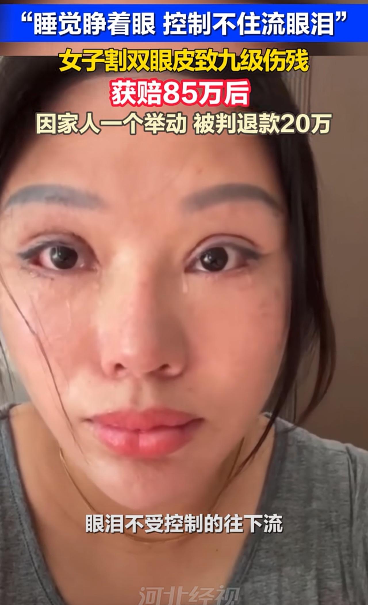 万万没想到，女子双眼皮割成九级伤残！

苏州女子王丽五年前经老乡介绍，
在孟某的