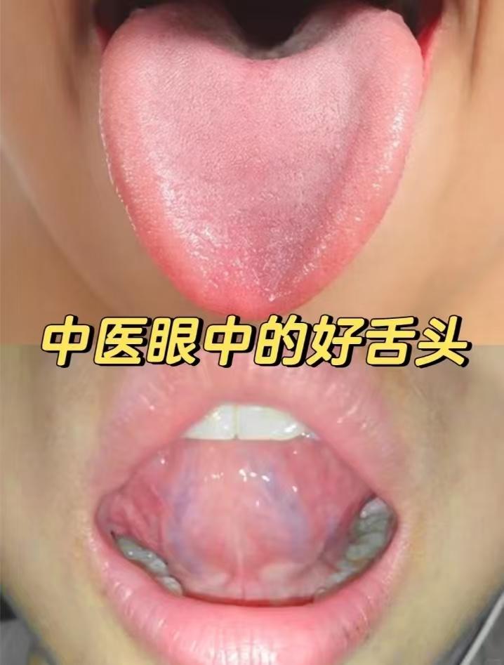 中医眼中健康的舌头，看舌下络脉、看舌态、看舌苔、看舌色、看舌形！
#科普##中医