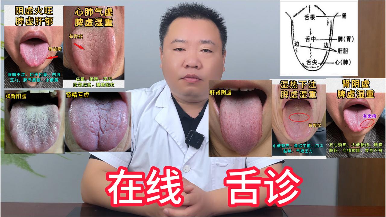大家好！我是武医生 免费帮粉丝看舌头，今天线上舌诊第5天 [无辜笑][无辜笑]