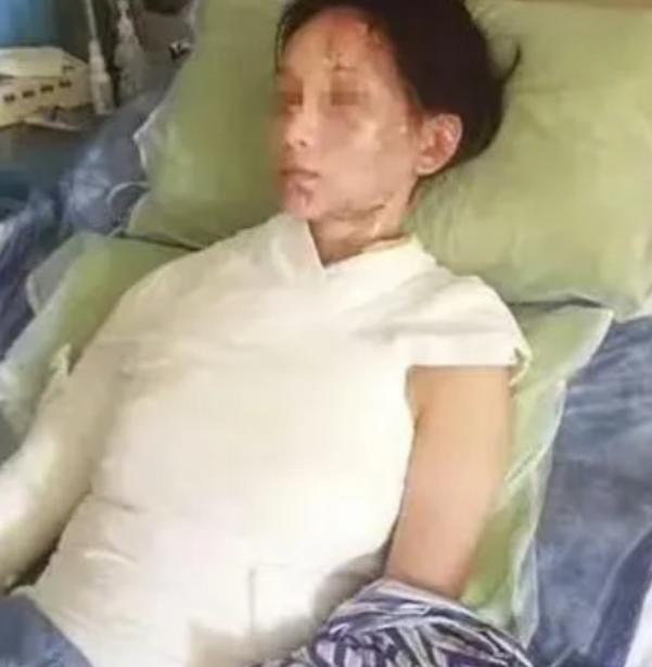 这就是嘴欠的下场！一盆滚烫高汤从头顶浇下，28岁温州姑娘林某的面容瞬间被高温吞噬