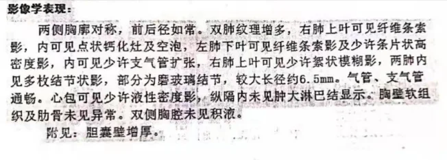 59岁的高先生，体检发现肺部有一个6.5mm磨玻璃结节。当地医生建议观...