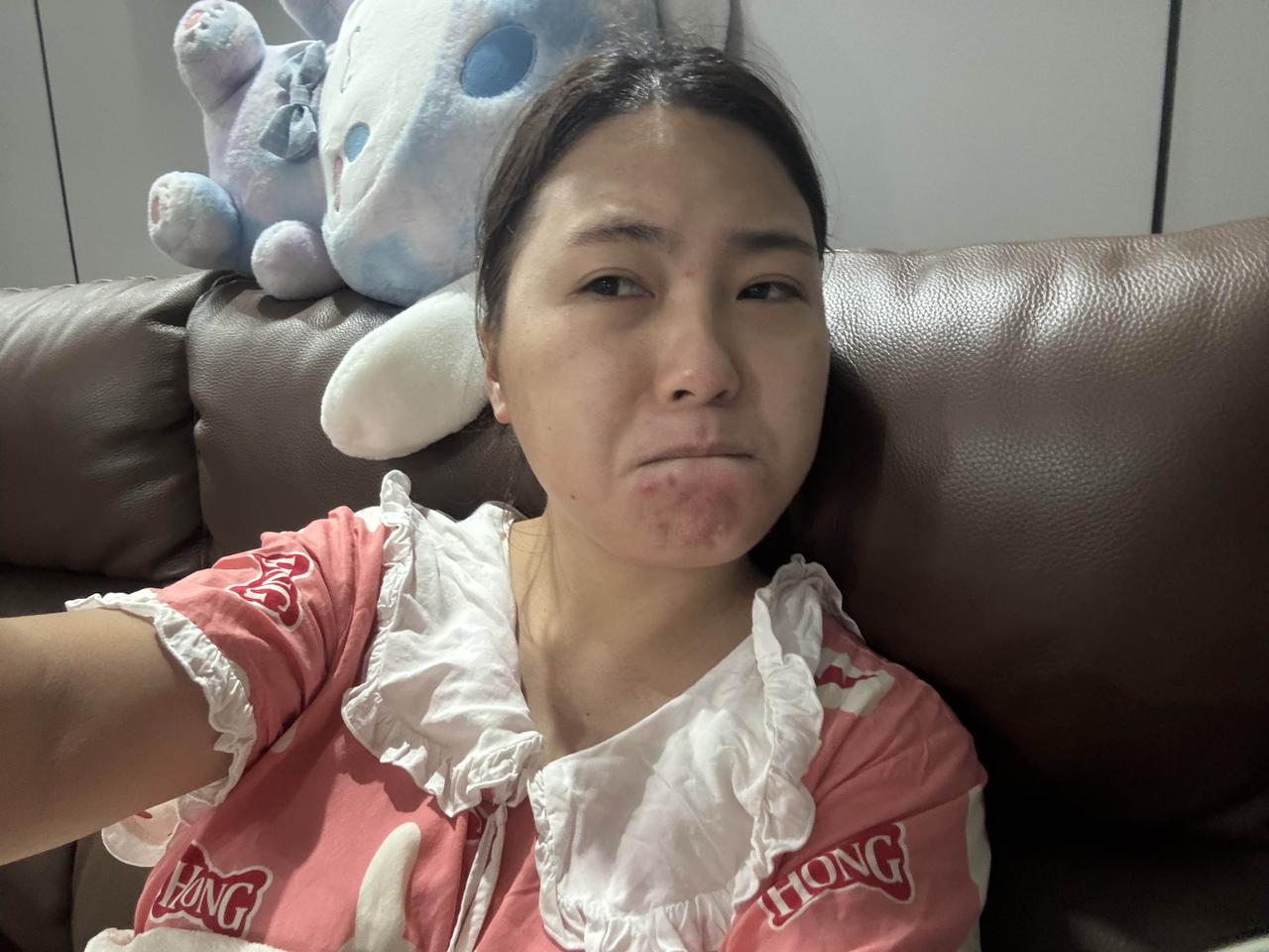我广西小九很久没长痘了，这几天被这几个男人气得急火攻心，现在广西炮哥也是盼着我离