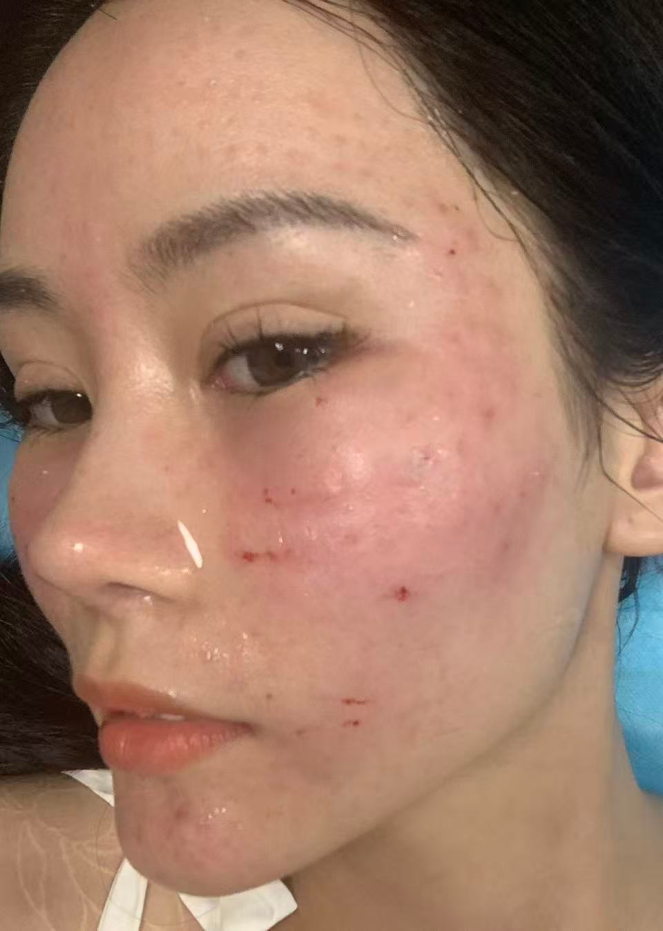 角度很刁钻但是感觉躺下来，尤其是做项目的时候不能找角度，可以拿来写功课。口周抗衰
