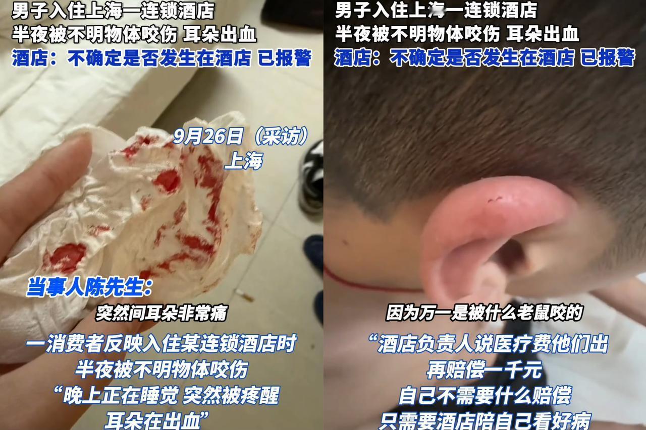 “倒大霉了！”
上海一男子半夜在酒店休息时，
突然感觉有东西在咬他耳朵，男子猛地