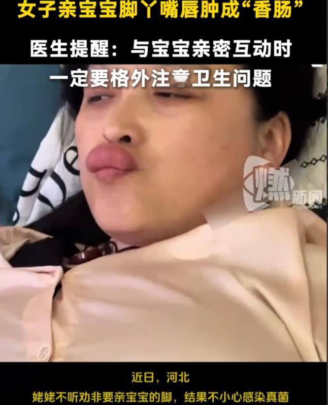 河北，一女子见外孙可爱，不顾女儿劝阻非要亲吻娃的小脚。谁料这一亲竟让嘴唇迅速肿成