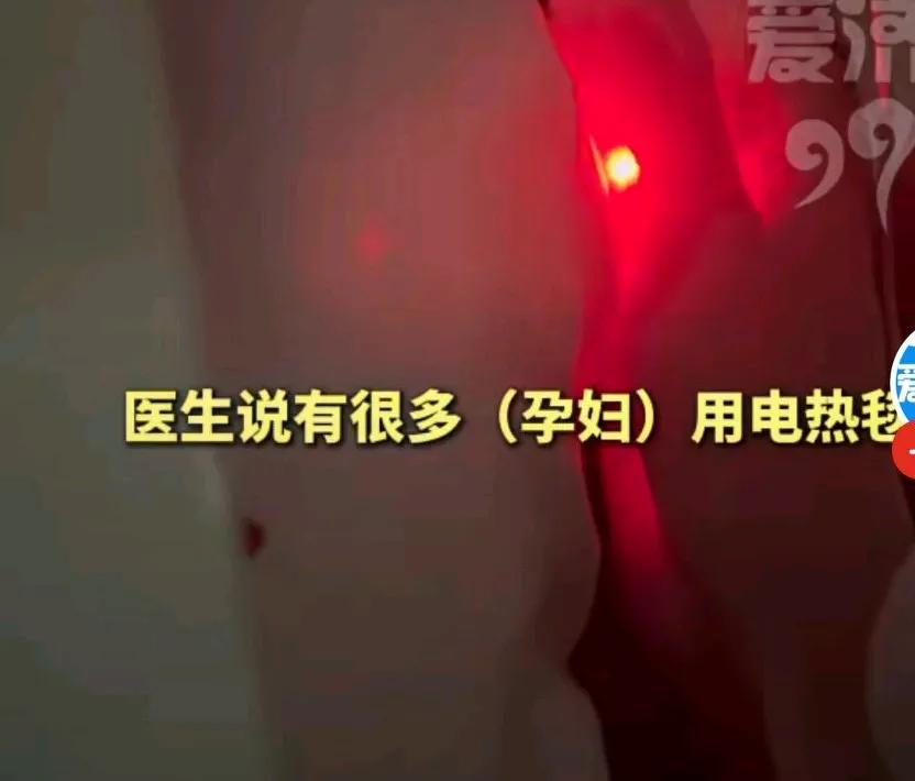 女子孕早期使用电热毯差点出意外，她说肚子疼的厉害，去医院检查，
医生说子宫内出现