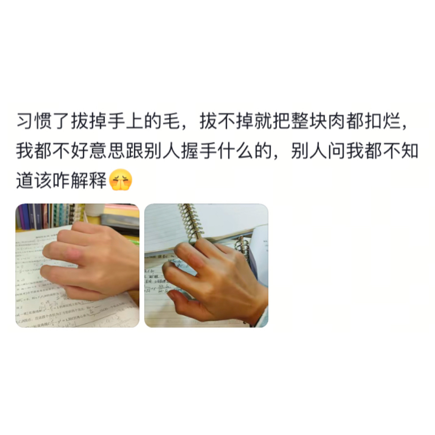 高中留在身体上的印记在慢慢消失