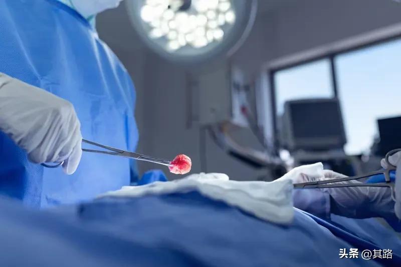 女子顺产分娩直肠被切漏，这事儿听起来就离谱！2024年5月，河北任丘的李霞在任丘