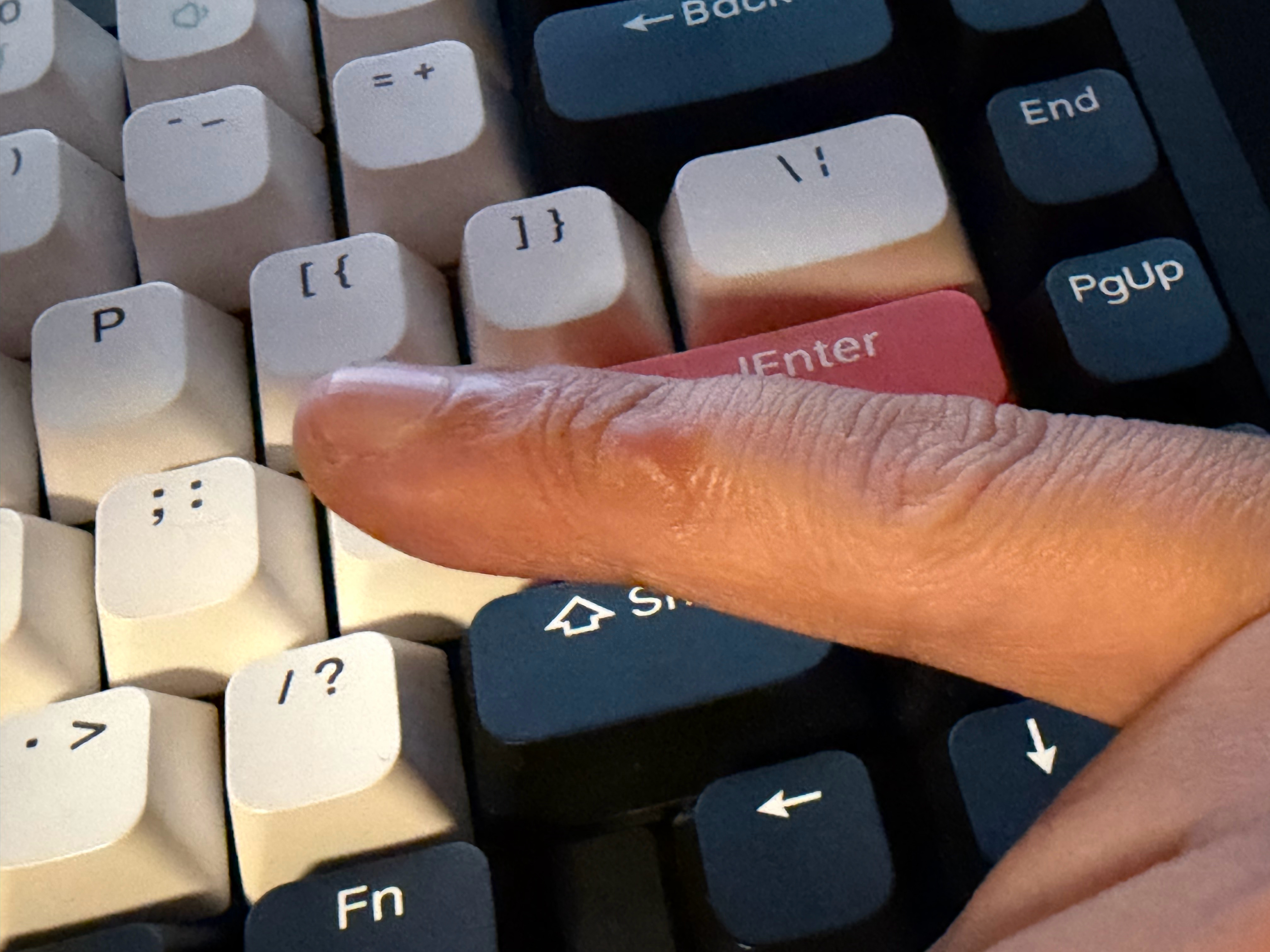 现在的智能手机越来越重，小手指都顶出了茧。智能手机太重顶出了 ​​​