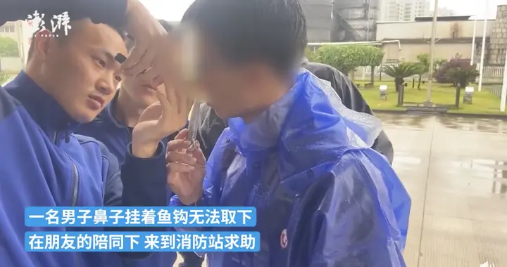 |男子钓鱼摘钩时鱼钩挂住鼻子，钩子直接刺入皮肉深处