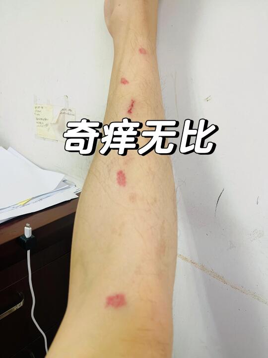 海南回来之后——我人麻了（SOS）