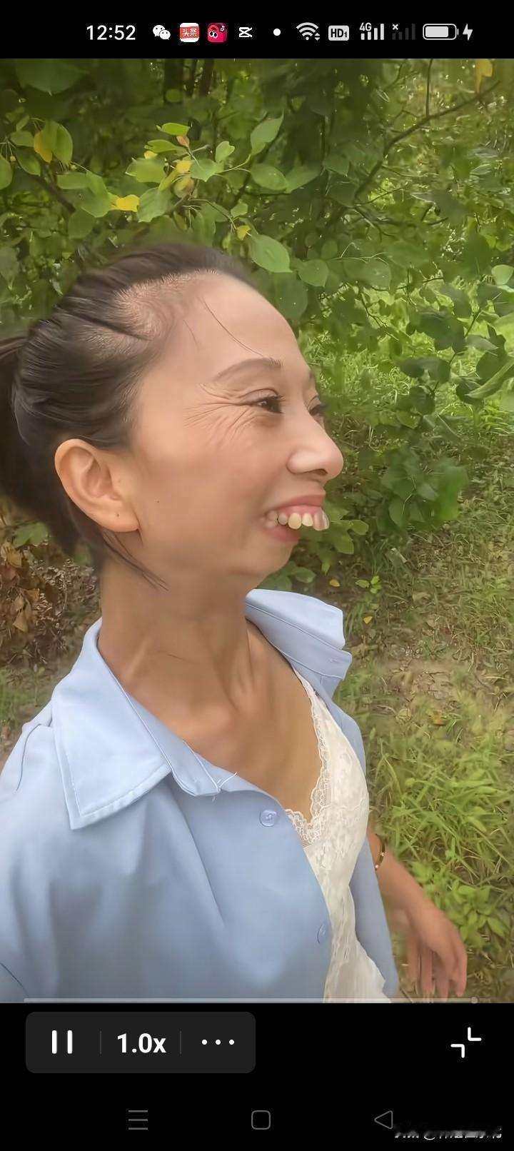 这女人的上牙和下牙都不对着，她怎么嚼饭呢？大门牙女