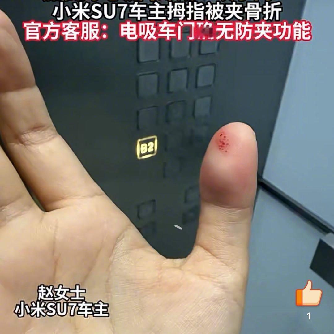 苏州车主拇指骨折！小米SU7电吸门“咬人”，这不是个例！

小米官方确认了：SU