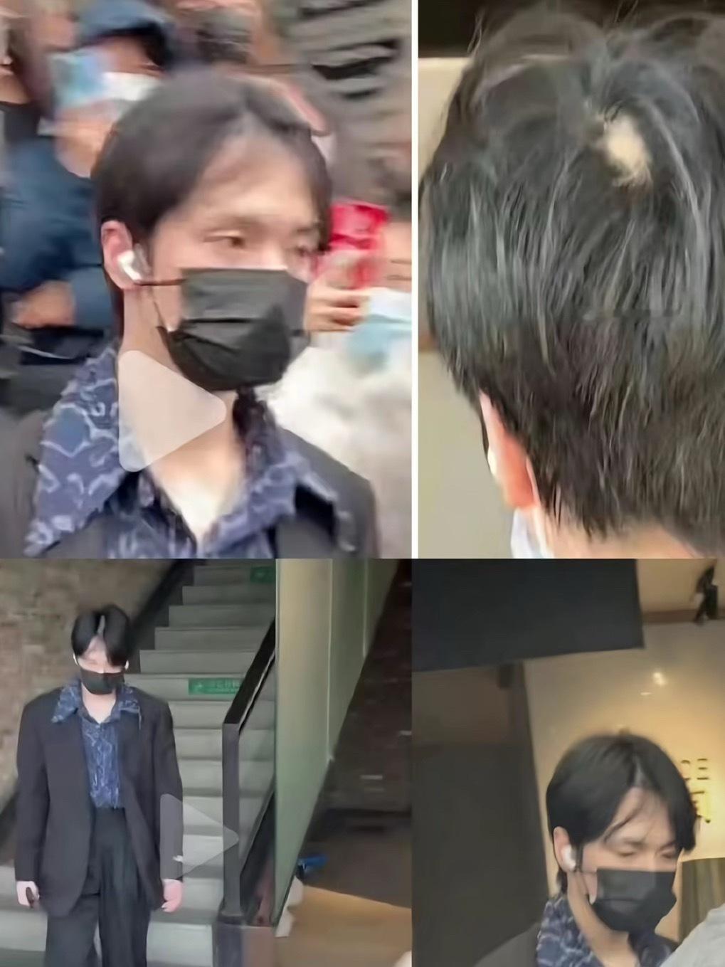 这后脑勺是严浩翔的吗？怎么秃了一块 