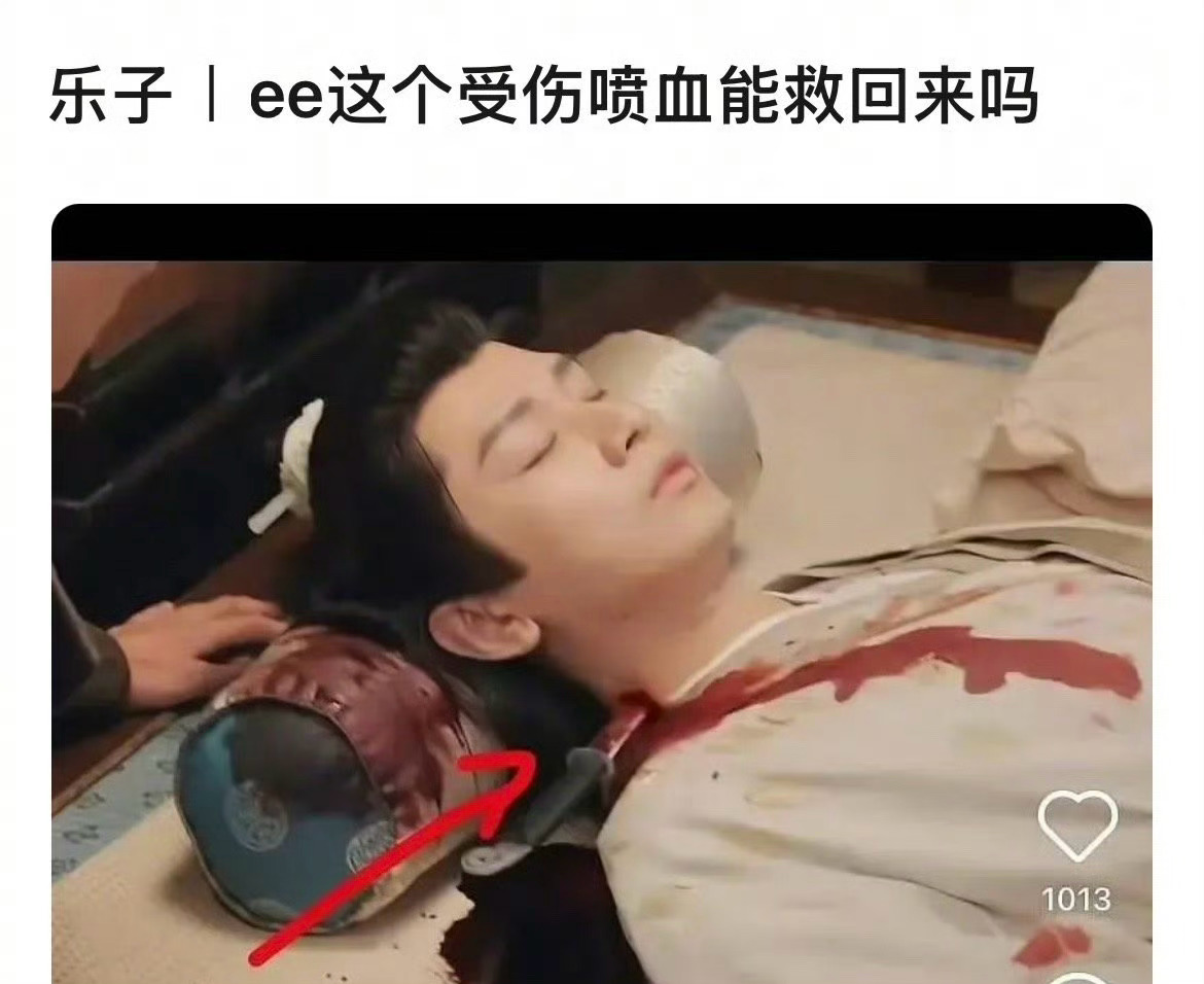 有网友说，成毅在剧里这个受伤还能救回来的话，就不太符合常理！