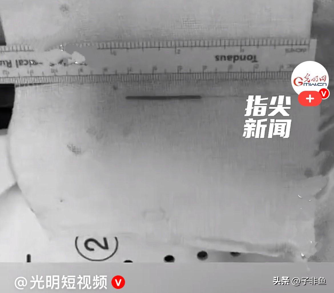 近日，辽宁沈阳的王先生前段时间他身体一直不适，频繁咳嗽、咳出黄痰，一侧胸口还隐隐