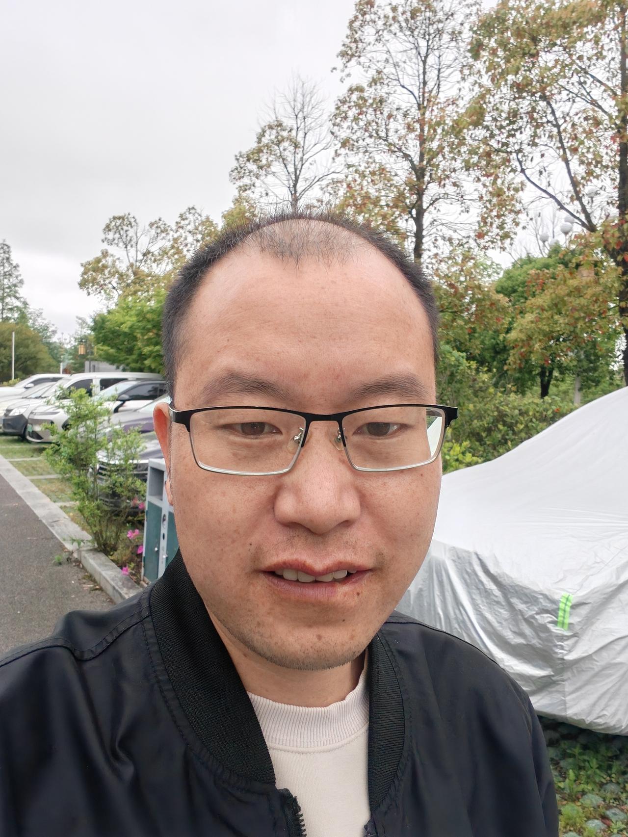我刷到评论区有人吐槽我头发少快秃顶，还有人看我嘴角破了，就瞎猜是不是交易亏钱亏得