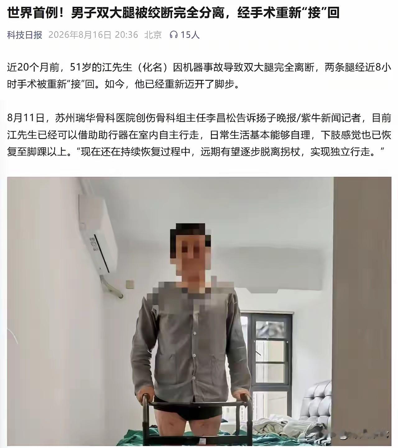 这种牛逼新闻，要是换个国家，那就是人类之光。中国骨科确实厉害！

瑞华医院，苏州