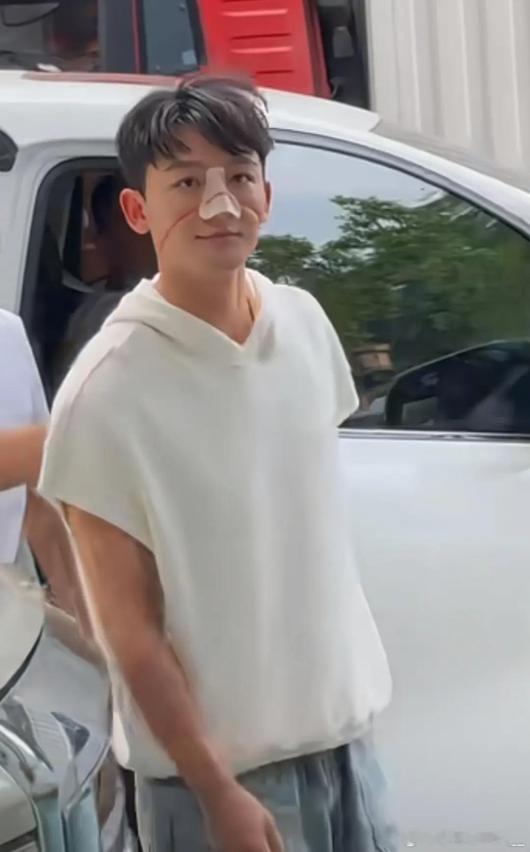 张晚意的鼻子怎么了？看起来好严重啊 
