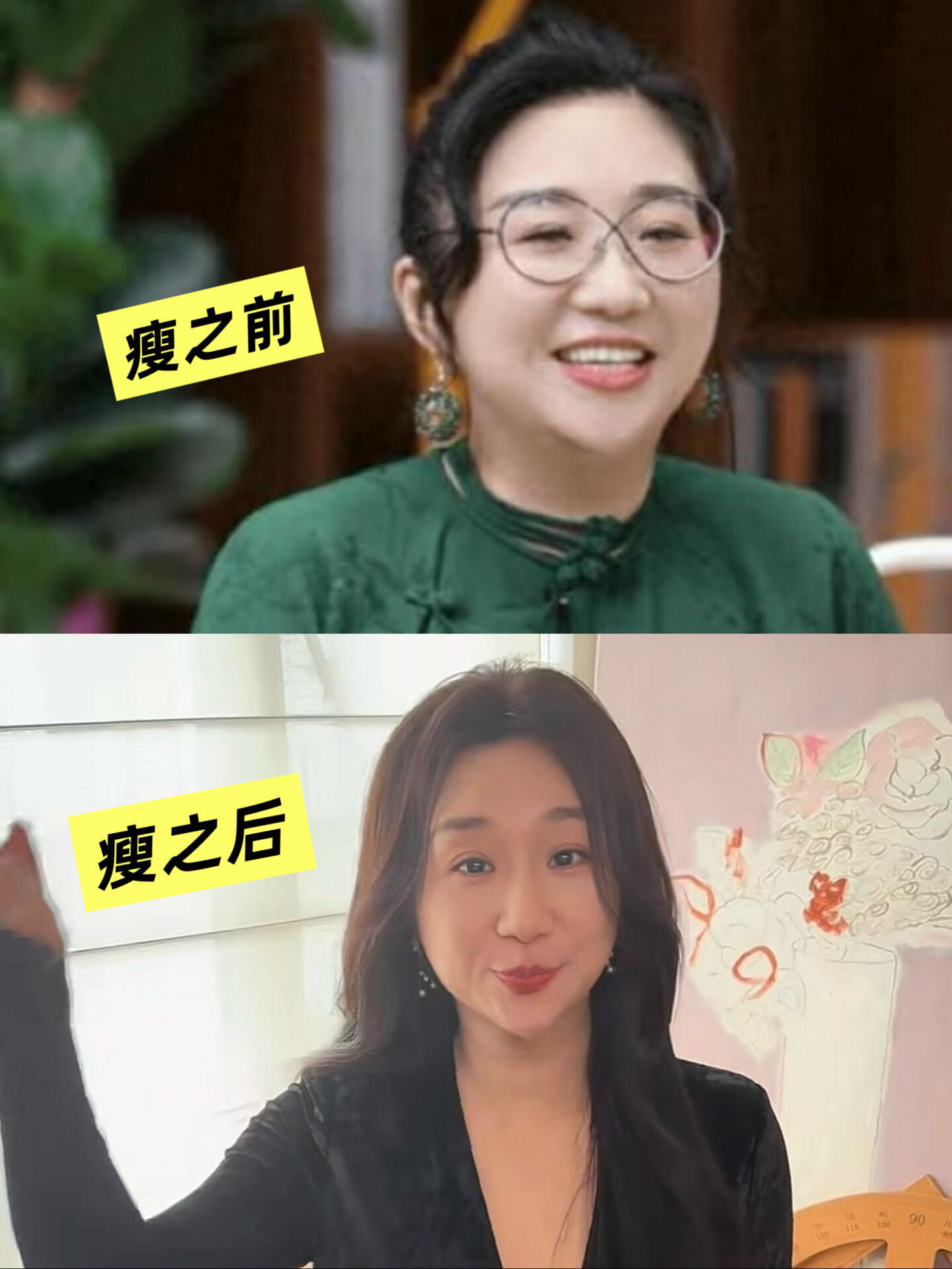 “傅首尔面相”以为瘦下来就没事了，殊不知傅首尔的面相，最大的弊端是发尖的下巴，让