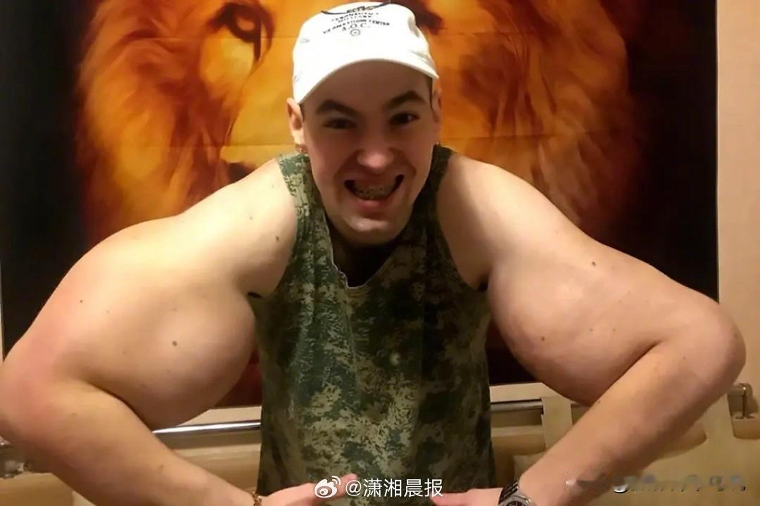 俄罗斯汉子居然注射凡士林健身，结果恐怕要废掉双臂。要说健身方法可太多了，有靠吃的