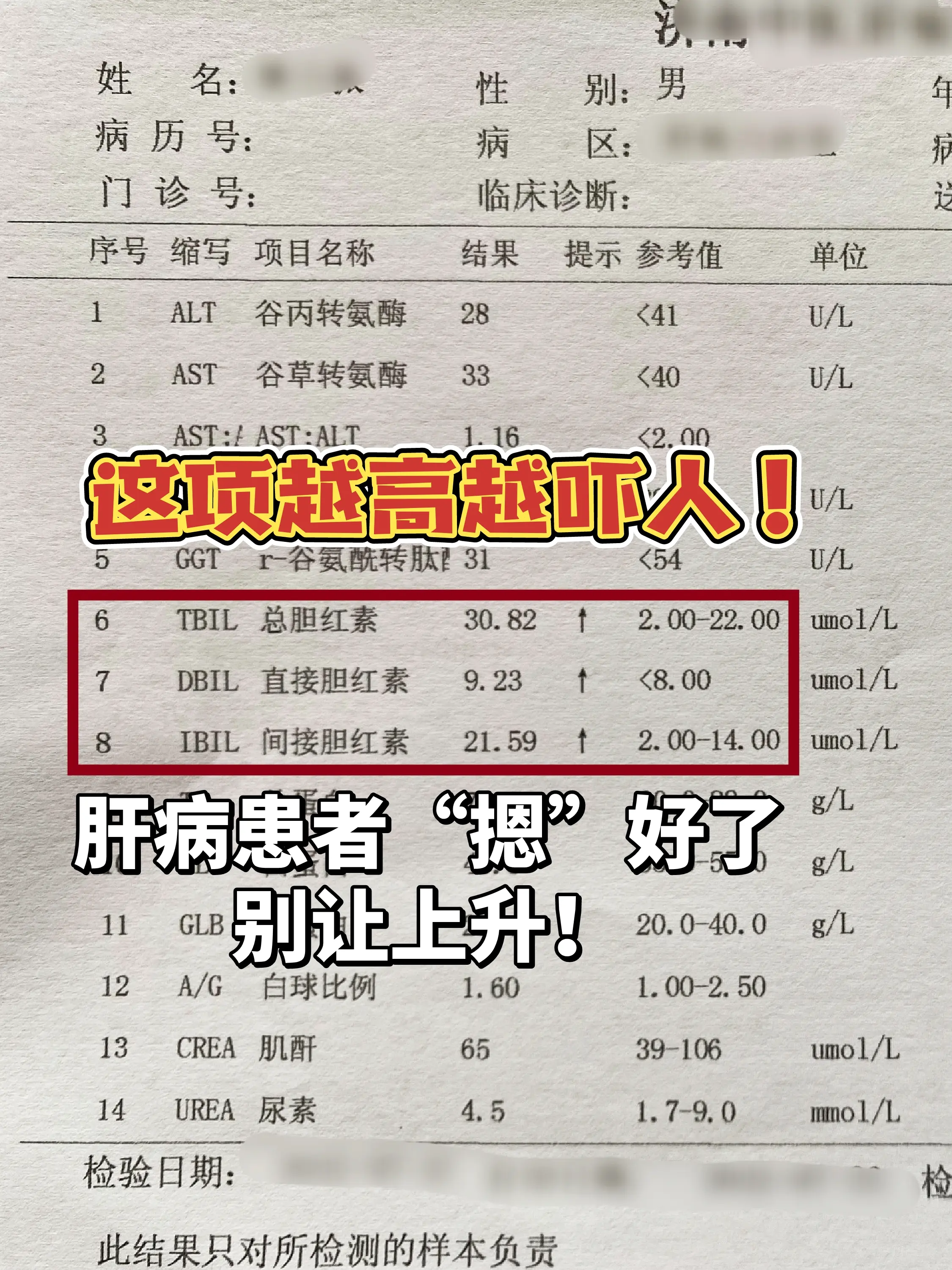 大家看，我图上圈出来的三项指标是肝功能报告单中的胆红素，包括总胆红素...