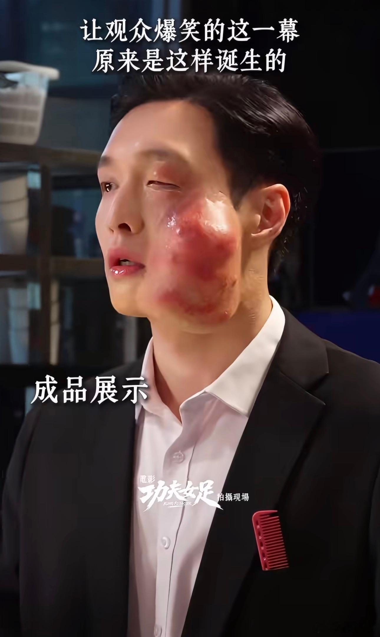 张艺兴肿脸特效妆张艺兴在《功夫女足》完全抛下偶像包袱，肿脸特效妆效果逼真又滑稽，