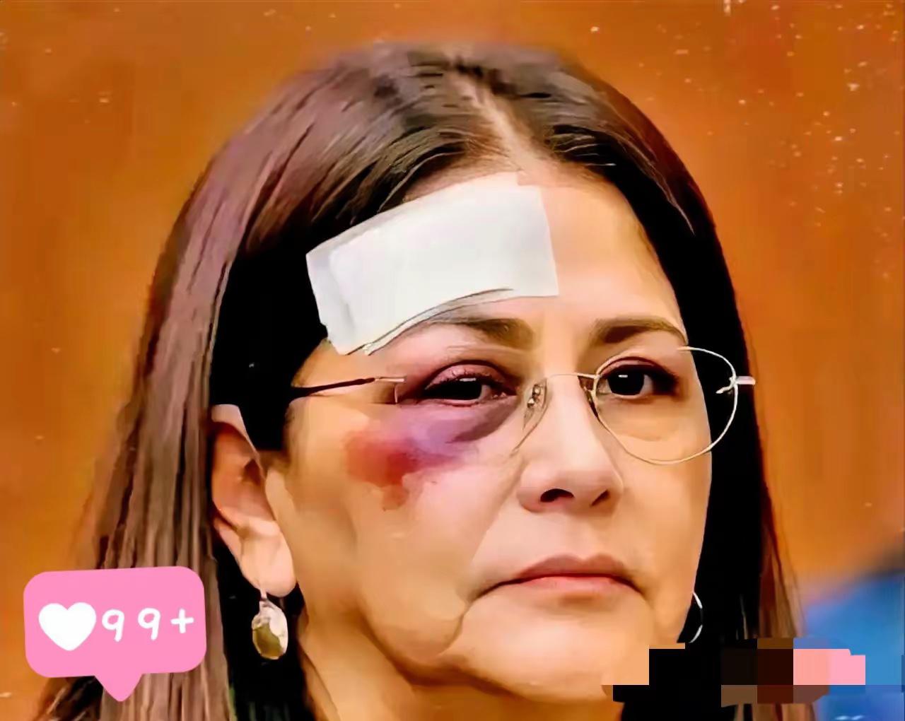 1月12日，石破茂接受路透社的采访时说：“高市早苗已经没有撤回涉台言论的必要了。