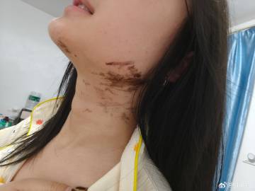 回归黑发，然后染了一脖子<span class=