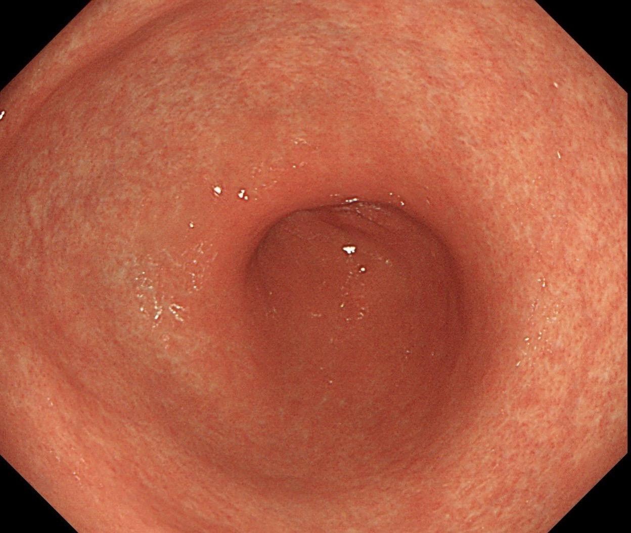 萎缩背景，注意那些微小的发黄色调。