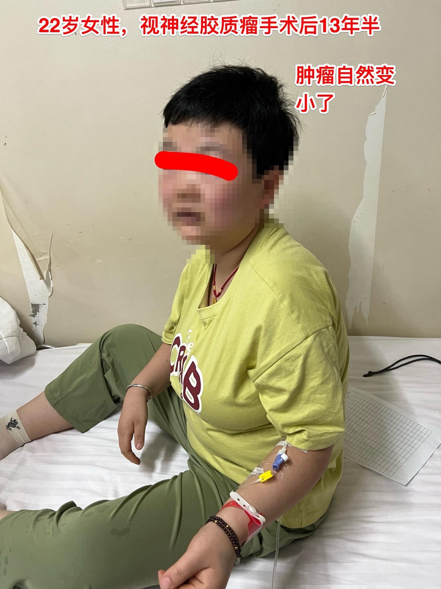 视神经胶质瘤很神奇-视神经胶质瘤是比较奇特的胶质瘤，一般是WHO一级或...
