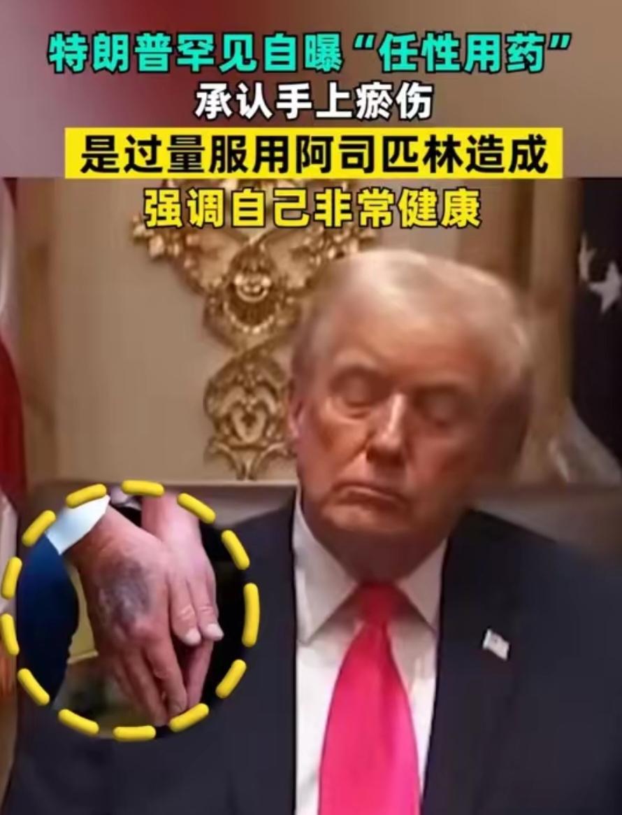 80多岁的特朗普精力超足，养生靠阿司匹林+快餐？和传统政客反差太大
 
特朗普，