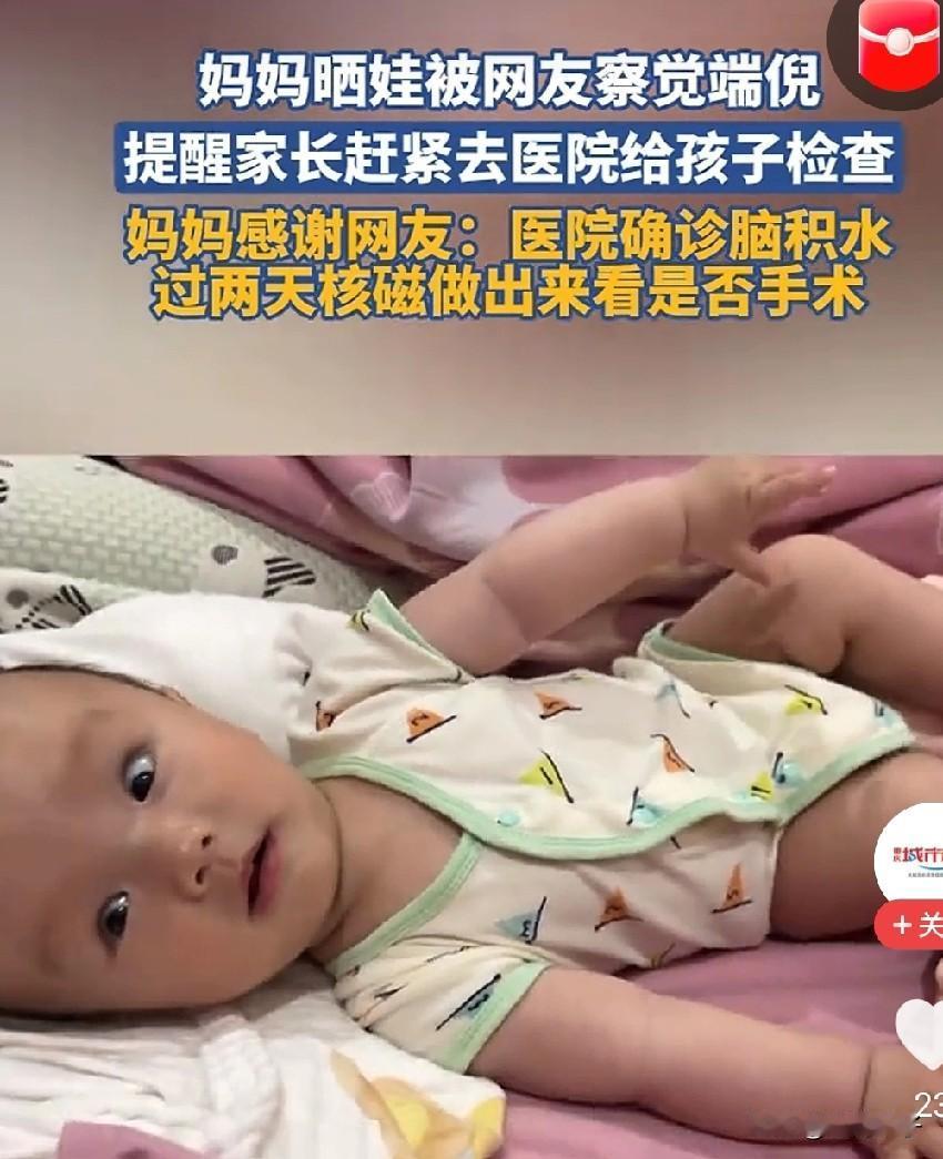 新手宝妈日常晒娃，全网都夸宝宝眼睛漂亮，唯独细心网友紧急喊话：快去医院检查！没想