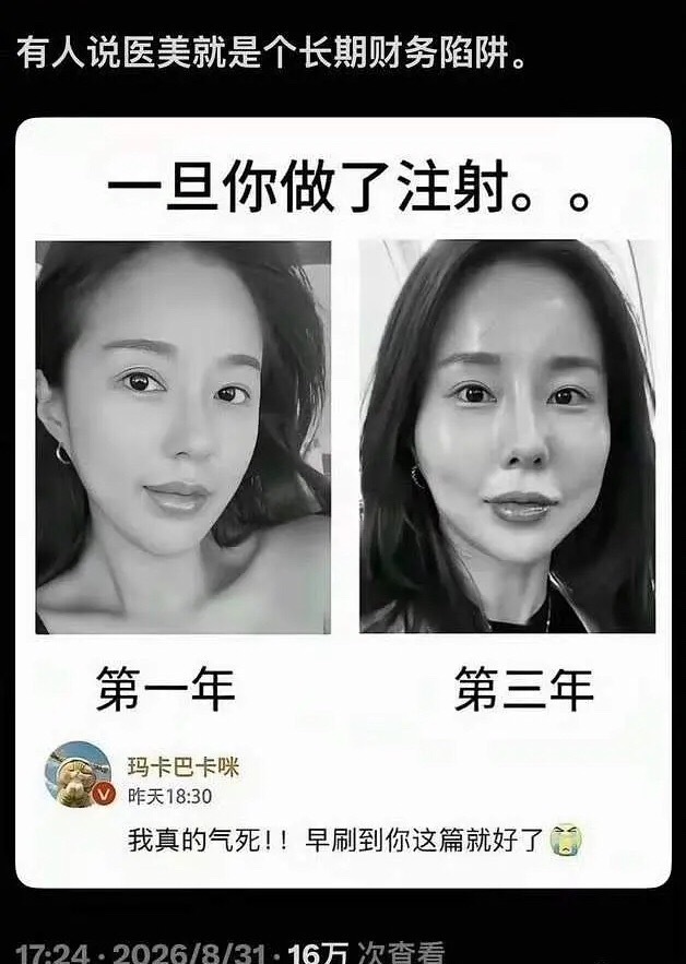 第二张图片真的好多人长这样 ​​​