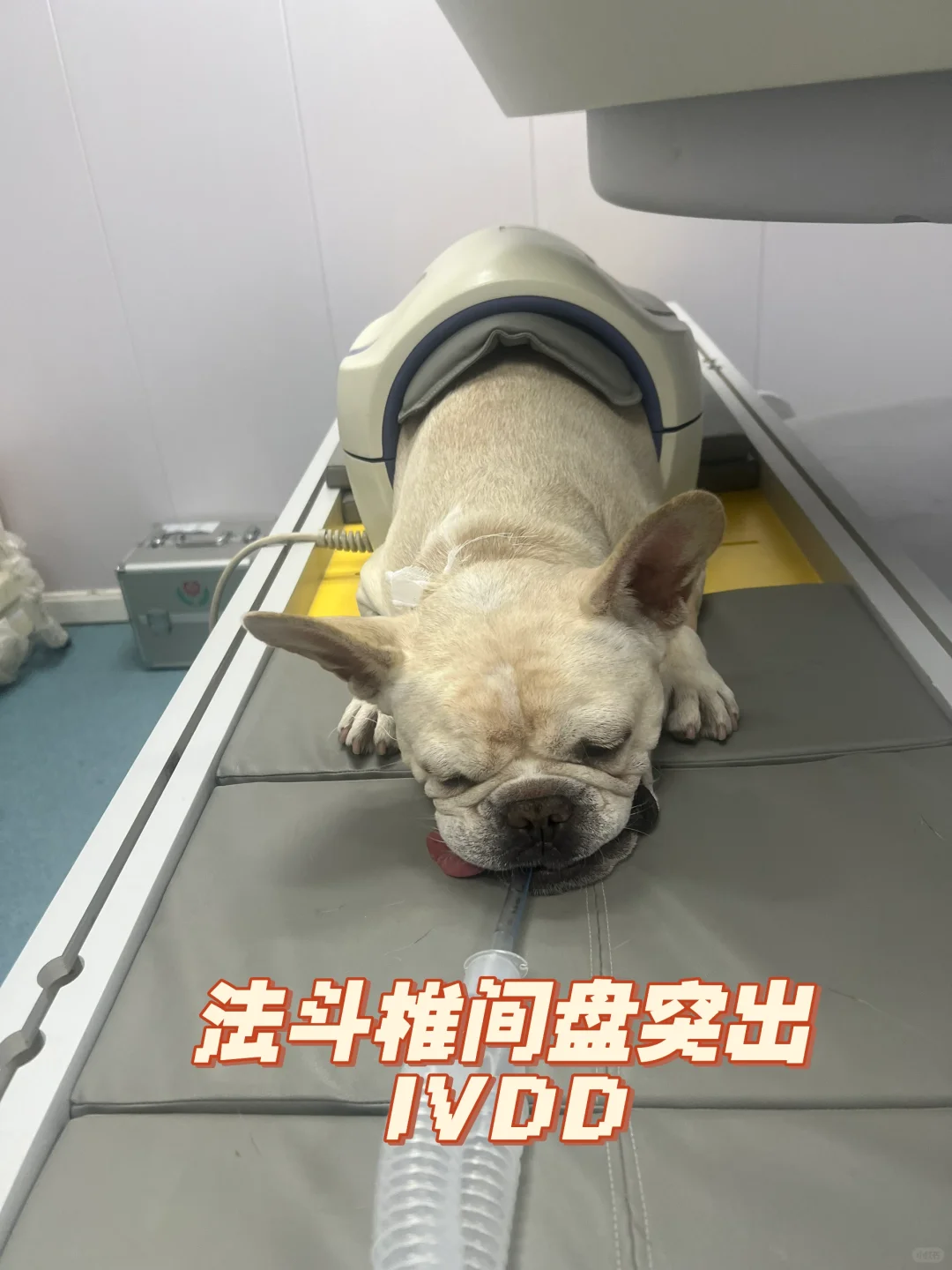 特别典型的法斗椎间盘突出