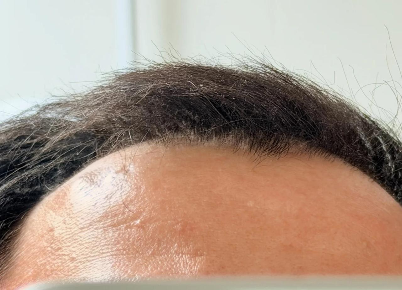 北京杨絮可以离谱到什么程度(๑•̌.•̑๑)ˀ̣
出个门，头发都白了[汗]杨絮的