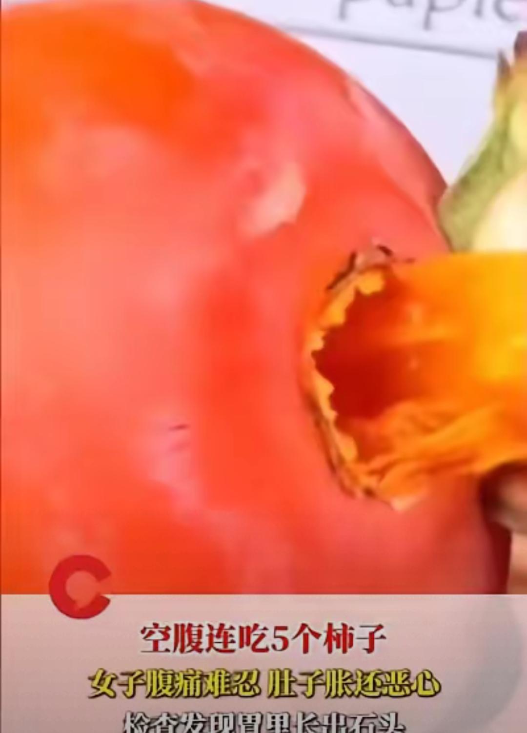 太吓人！空腹吃5个柿子竟长胃结石，别再把“常识误区”当小事，很多人都在踩坑！
 