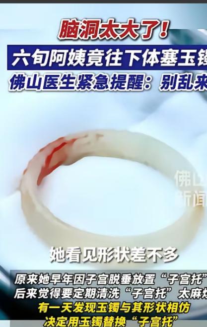 “聪明反被聪明误！”广东，一65岁阿姨因为“阴道异物”去医院检查，结果医生发现里