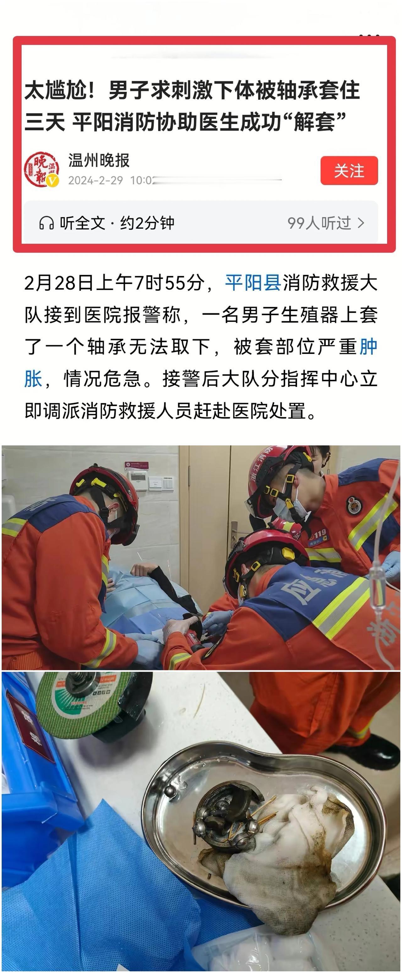 荒诞奇闻！男子生殖器被轴承套住三天，医生束手无策，平阳消防成功“解套”




