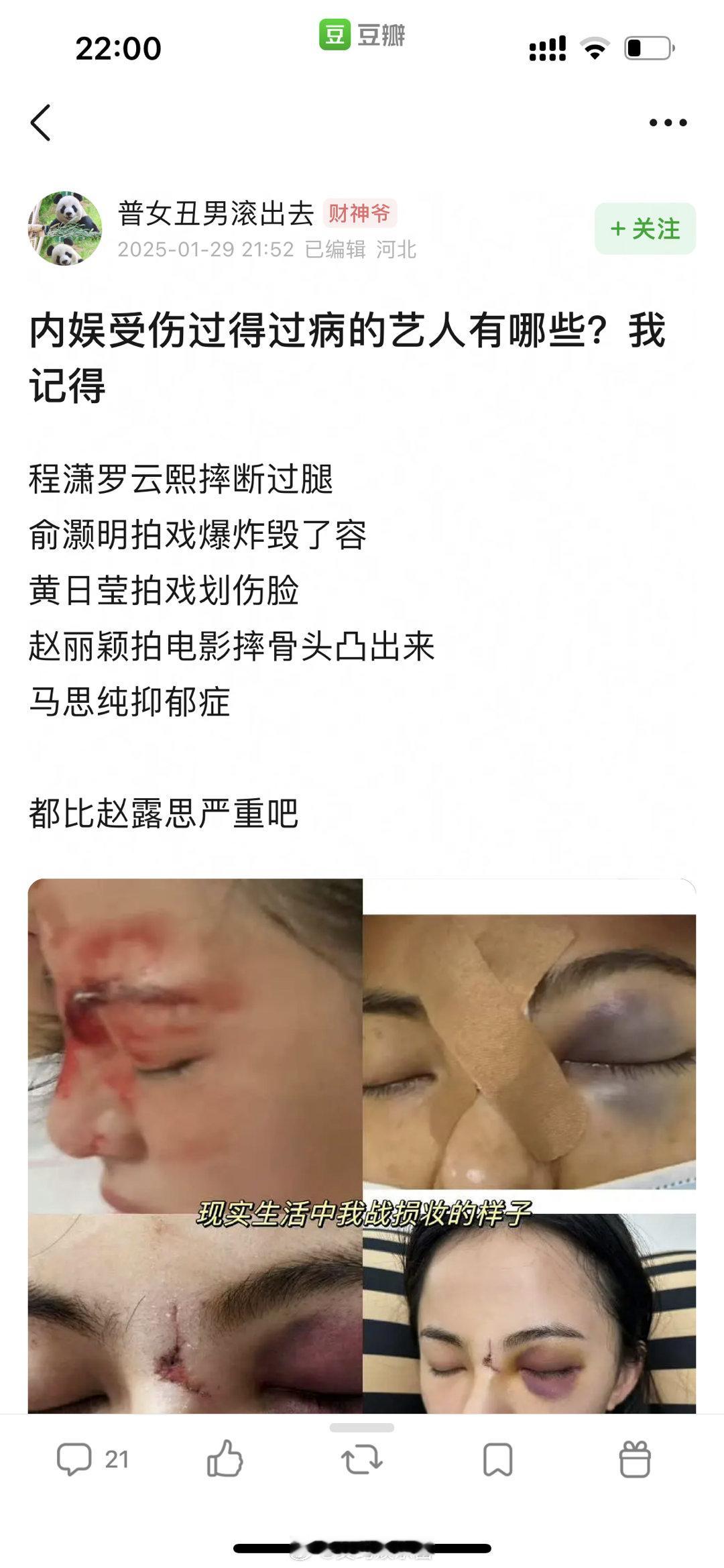 赵露思长文谈抑郁症 内娱艺人受过伤的不少呢吧，也有一些比赵露思严重的？网友说都应