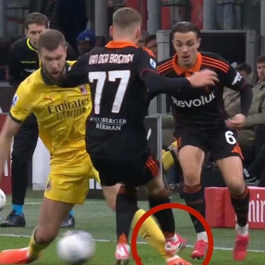 【帕夫洛维奇受伤】帕夫洛维奇左腿遭受高能量直接创伤，软组织广泛血肿，腓骨骨组织呈