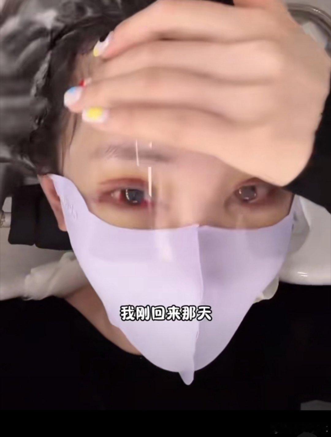 任权被整容后的薛小婉吓到了以前就很清纯很漂亮，现在看着眼睛也太吓人了，充血了都，