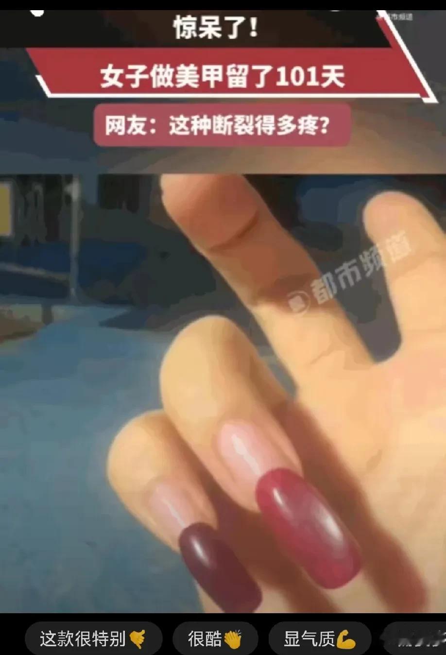惊呆了！河南一女生做美甲后，一直小心翼翼的保护着，直到第 101 天，她终于按耐