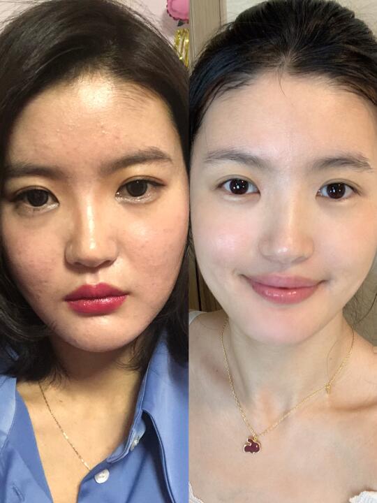 坚持一个月，身上湿气终于赶跑了 ～