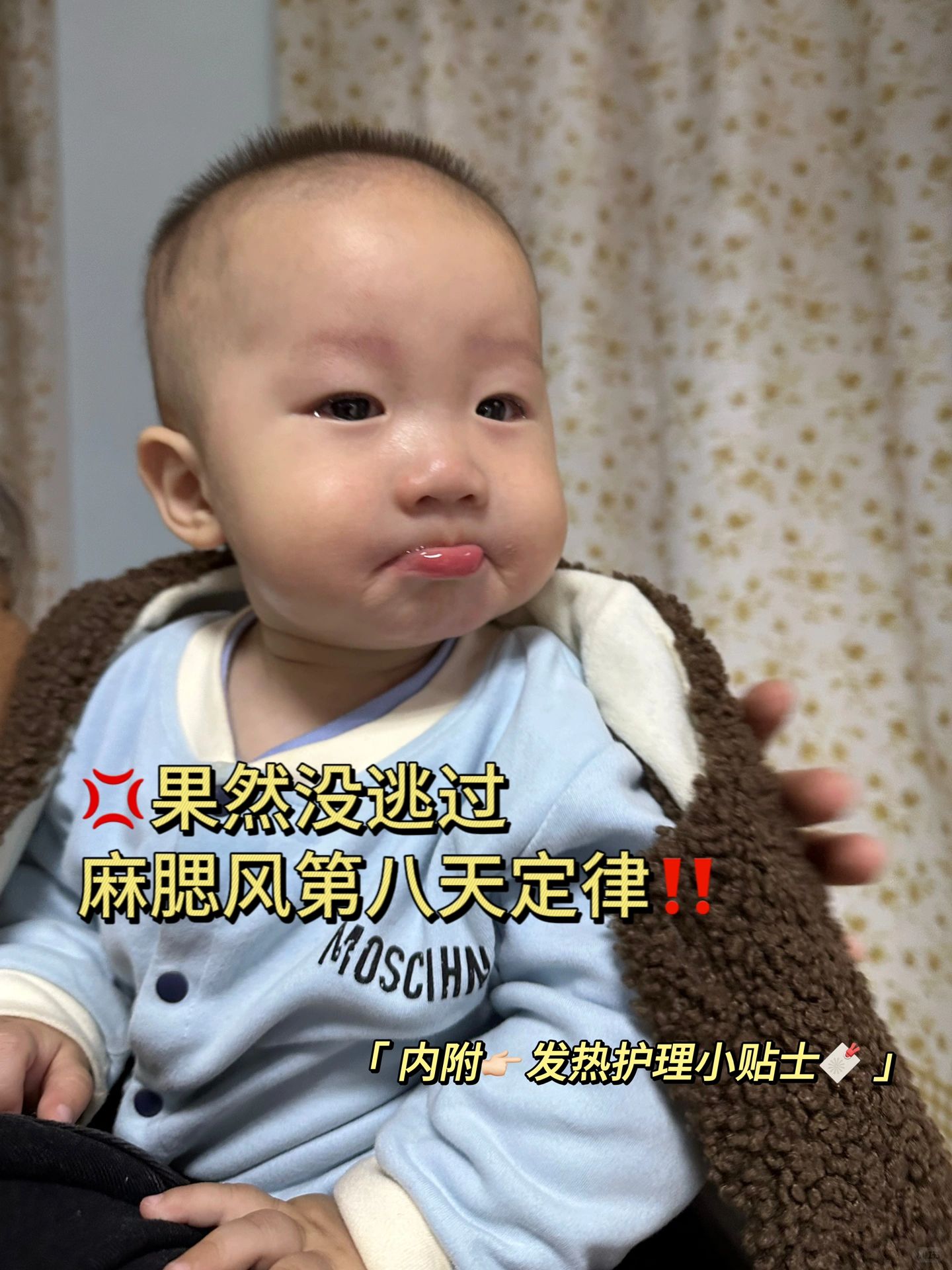 麻腮风第八天定律‼️果然名不虚传💔