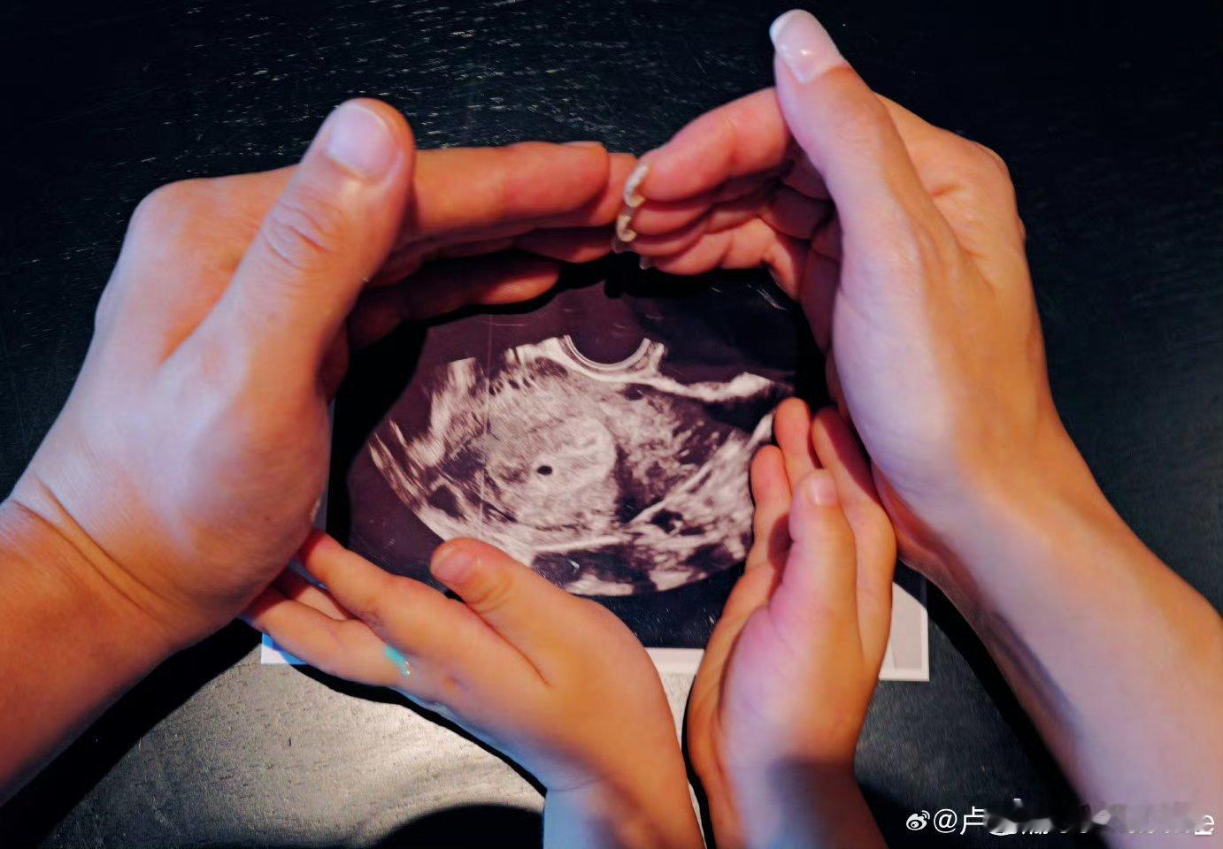 卢靖姗说二胎反应更大恭喜庚哥姗姐，一家四口，真好，幸福快乐呀 ​​​