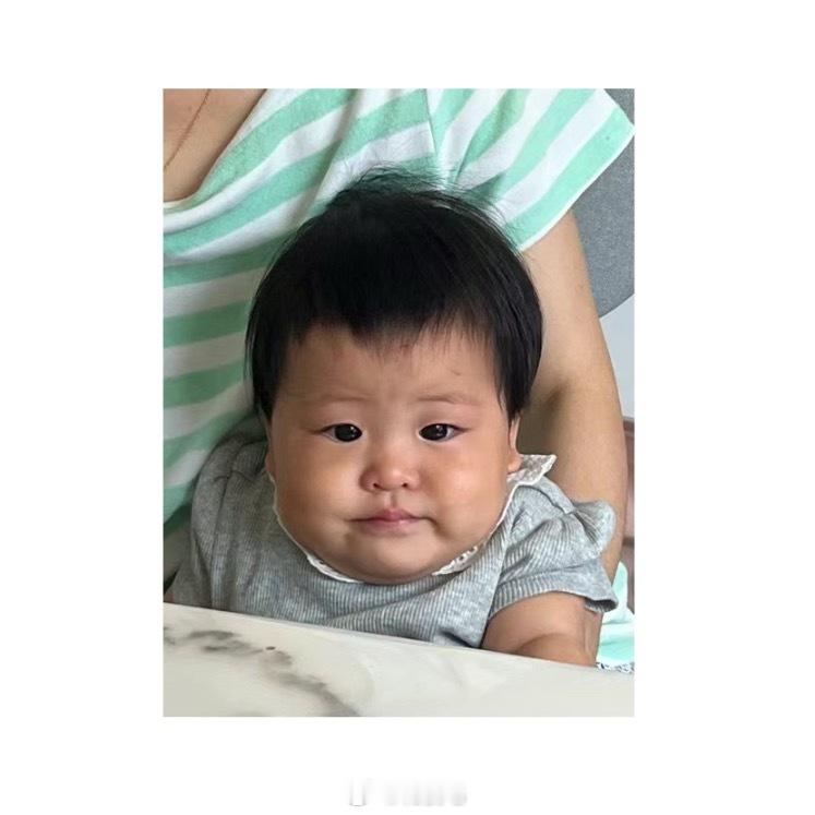 明确告知旅蛙我做医美了，让他看看有什么不一样是旅蛙指着我下巴的淤青说：这里黑掉了